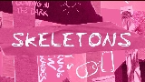 動画サムネイル Skeletons